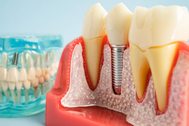 Oral Surgery in Avondale, LA